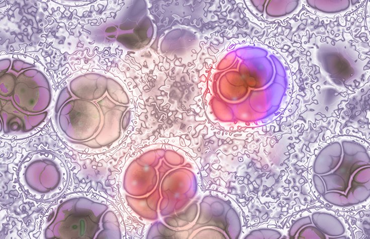 Molecular Profiling of Solid Tumors Collage