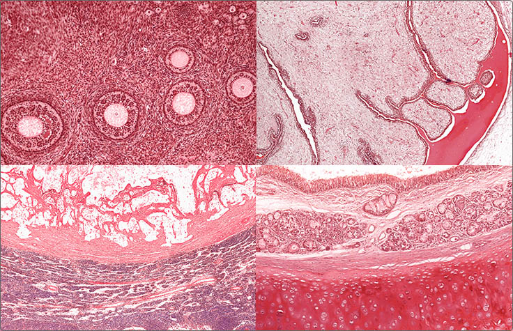 Molecular Analysis Across Cancer Types