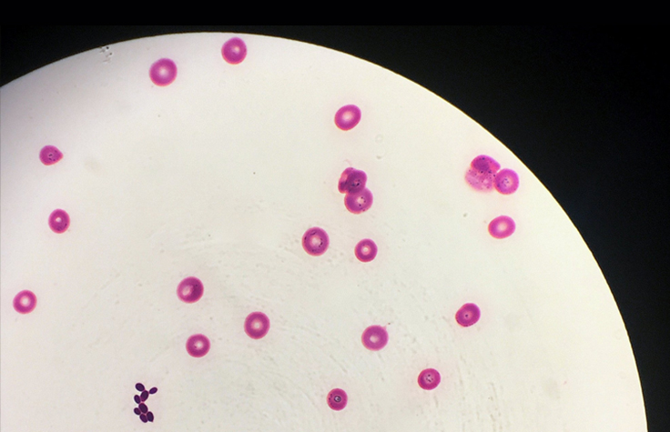 bacterial genome sequencing