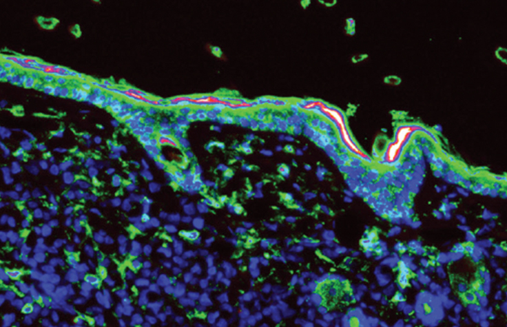 Introduction to Spatial Transcriptomics